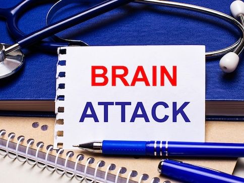 Metody diagnostyczne w badaniach móżdżku i układu nerwowego: Kompleksowy przegląd technik obrazowania i neurofizjologii