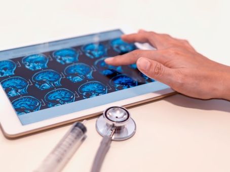 Najnowsze badania neurologiczne nad móżdżkiem 2026: przełomy i wyzwania