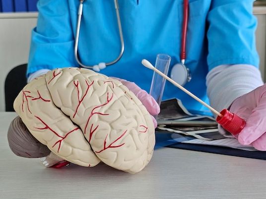 Zaburzenia móżdżku – objawy, diagnoza i skuteczne metody leczenia